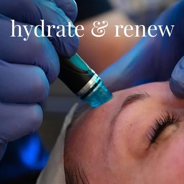 Hydro-Facial at lillyrosebeauty in Murrieta, CA